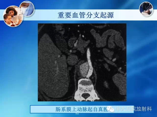 主动脉病变病理基础和影像表现
