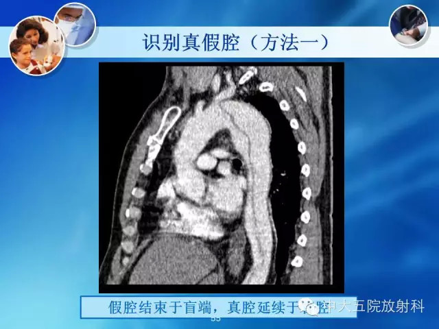 主动脉病变病理基础和影像表现