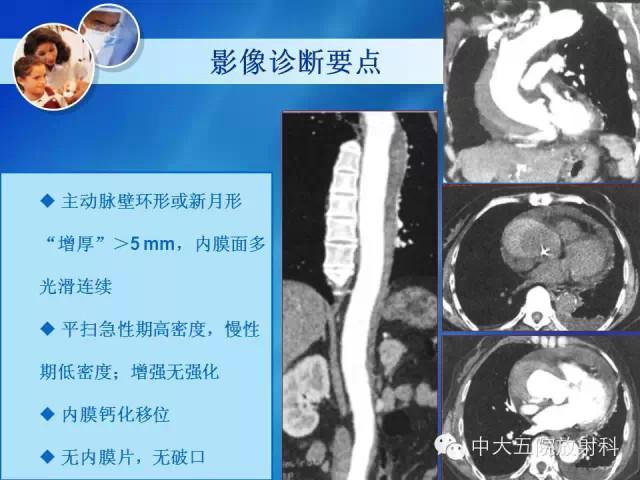 主动脉病变病理基础和影像表现
