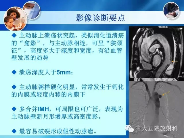 主动脉病变病理基础和影像表现