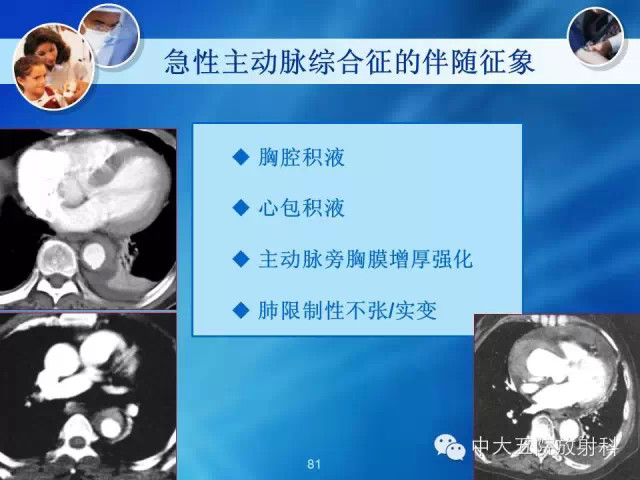 主动脉病变病理基础和影像表现