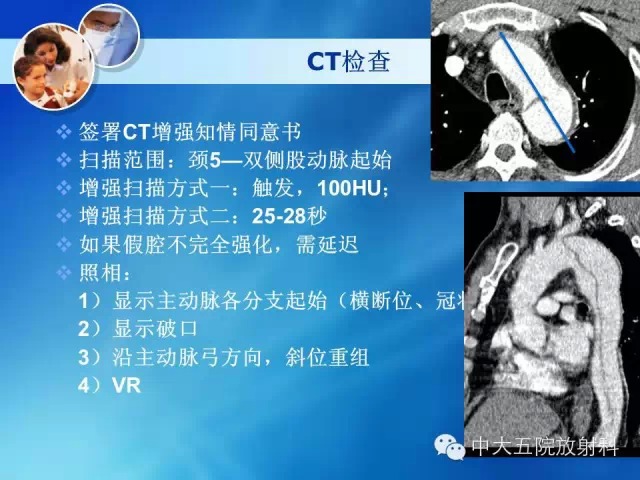 主动脉病变病理基础和影像表现