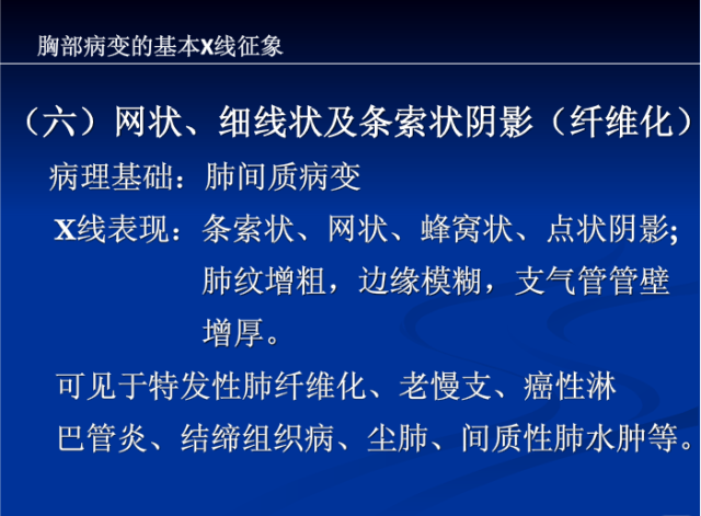 肺部X线诊断