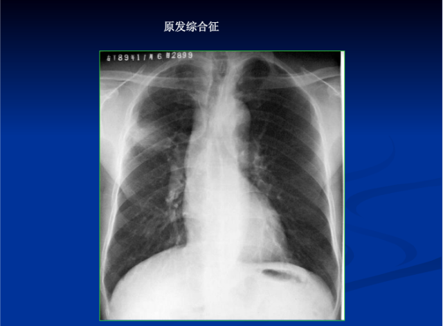 肺部X线诊断