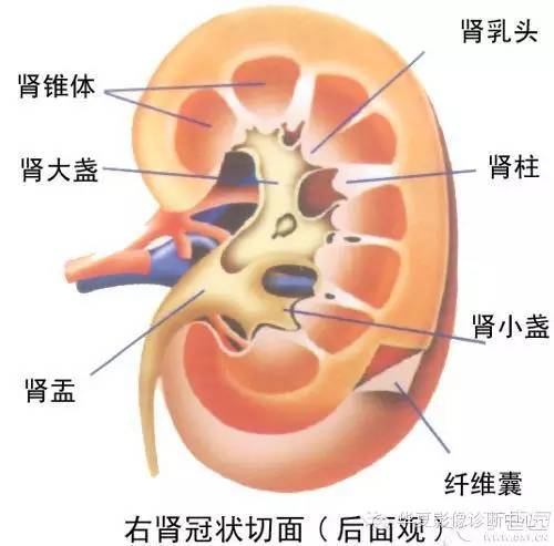 【病例学习】髓质海绵肾的CT表现 【病例学习】髓质海绵肾的CT表现