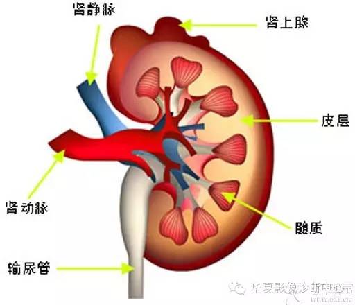 【病例学习】髓质海绵肾的CT表现 【病例学习】髓质海绵肾的CT表现