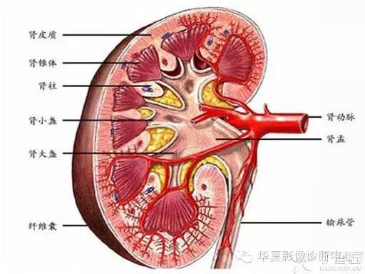 【病例学习】髓质海绵肾的CT表现 【病例学习】髓质海绵肾的CT表现