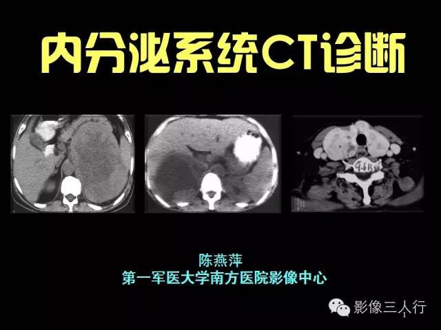 内分泌系统CT诊断