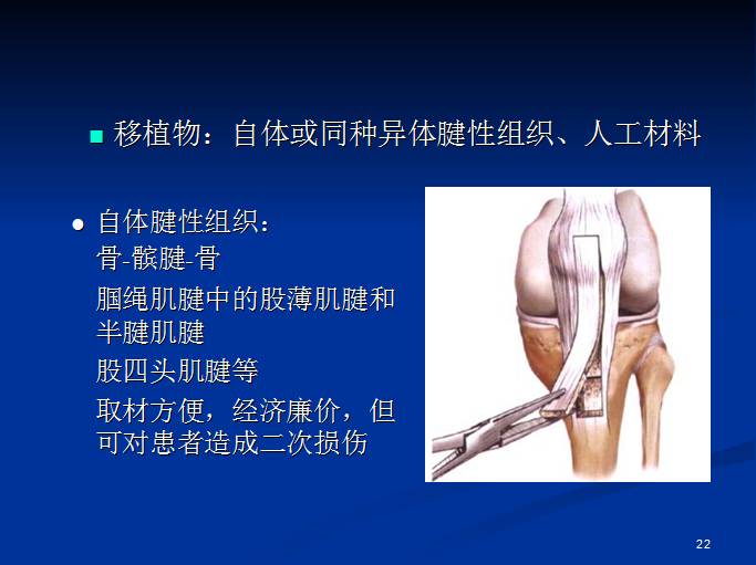 半月板和前交叉韧带术后的MRI评价