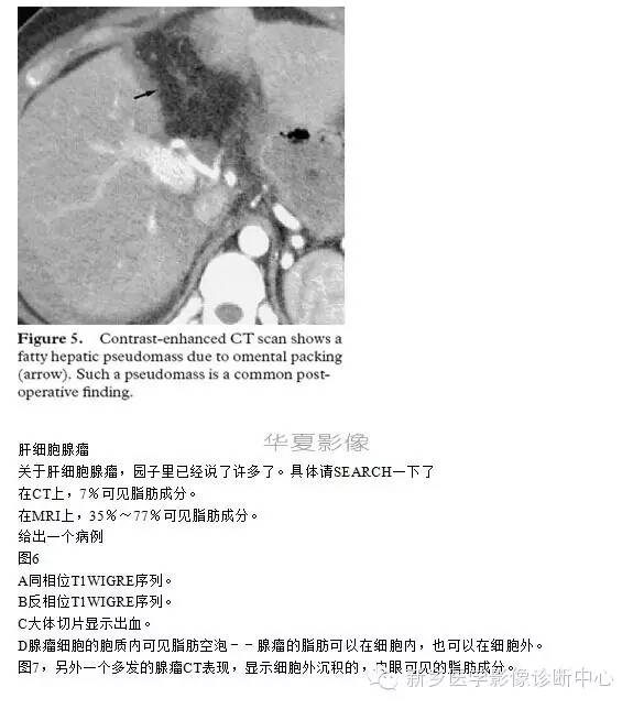 肝内含脂性良性病变
