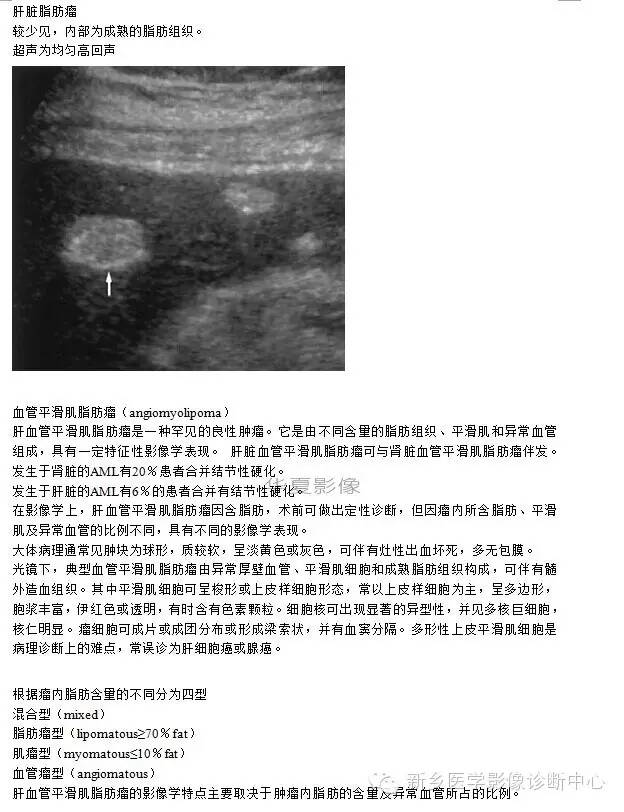肝内含脂性良性病变