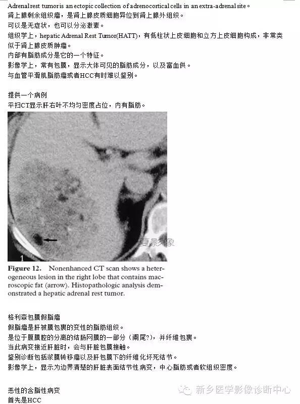 肝内含脂性良性病变