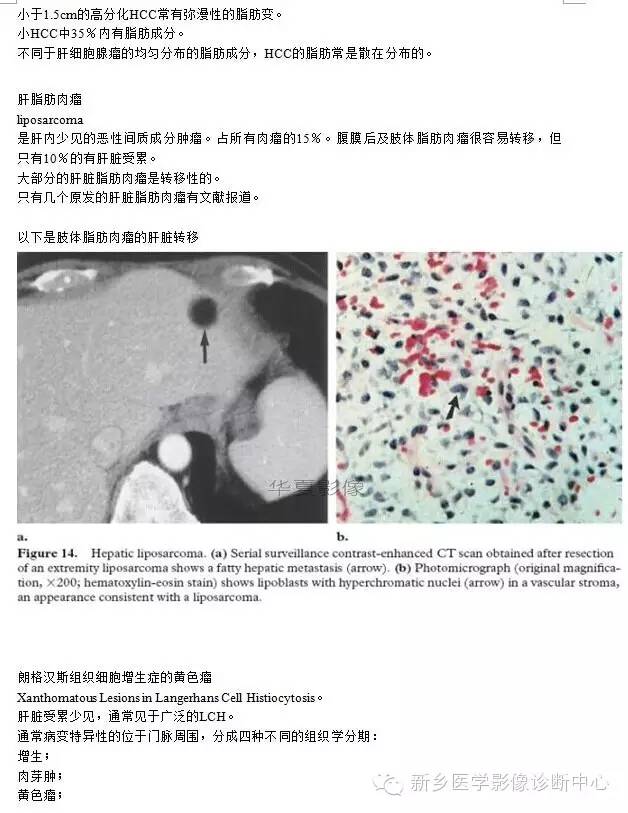 肝内含脂性良性病变