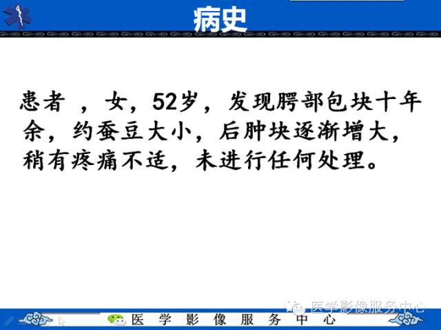 【病例学习】咽旁多形性腺瘤一例MR影像学表现