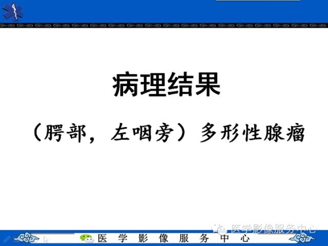 【病例学习】咽旁多形性腺瘤一例MR影像学表现