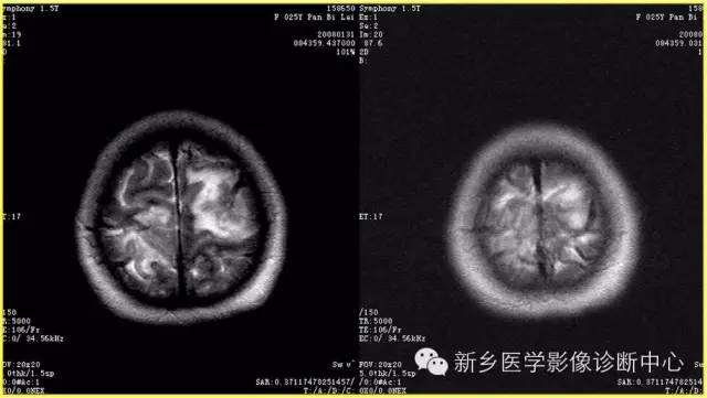 自动草稿