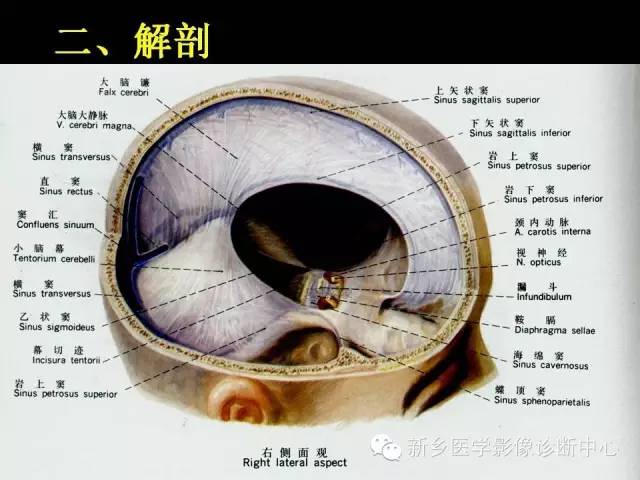 【病例学习】静脉窦血栓一例MR影像学表现