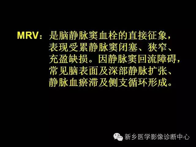 【病例学习】静脉窦血栓一例MR影像学表现