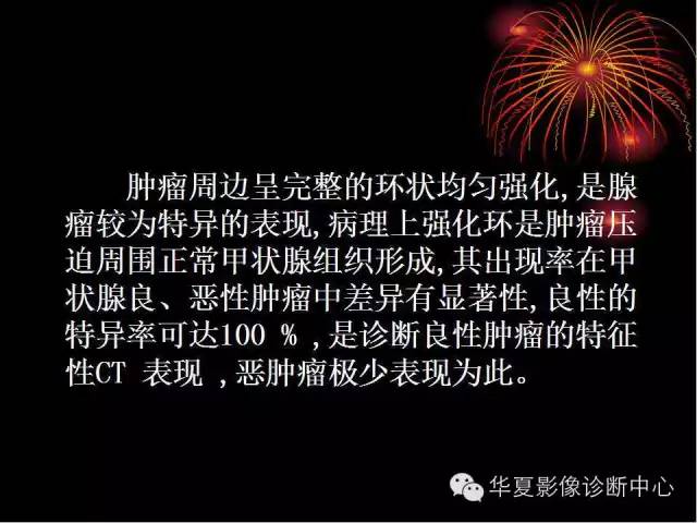 甲状腺肿瘤CT诊断分析及相关问题讨论
