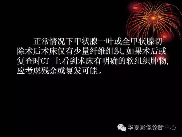 甲状腺肿瘤CT诊断分析及相关问题讨论