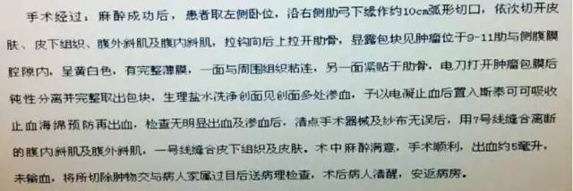 【病例学习】胸壁肋间神经鞘瘤一例CT影像表现