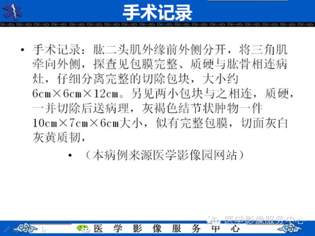【病例学习】软组织内恶性孤立性纤维肉瘤一例