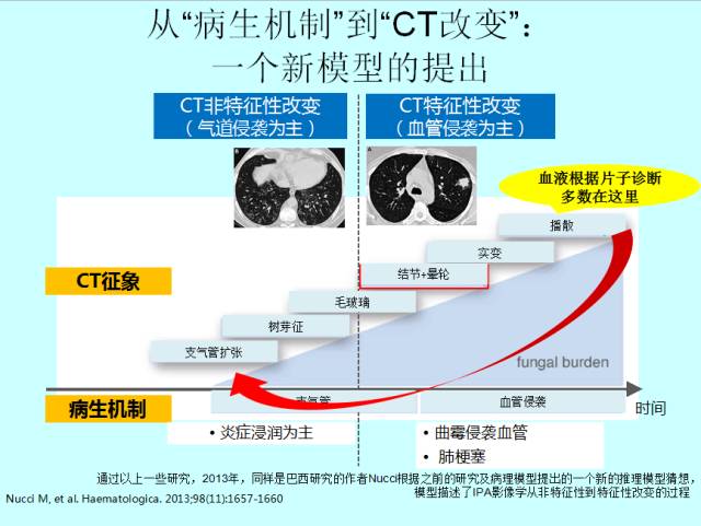 肺曲霉菌病分型与影像诊断