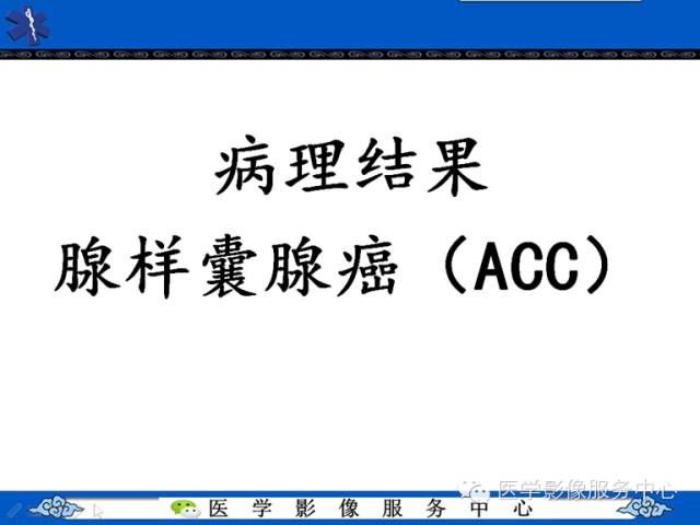 【病例学习】左眼眶腺样囊腺癌一例影像表现