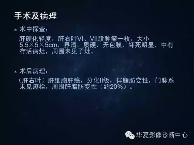 【病例学习】原发性肝癌伴脂肪变性一例影像表现