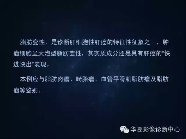【病例学习】原发性肝癌伴脂肪变性一例影像表现