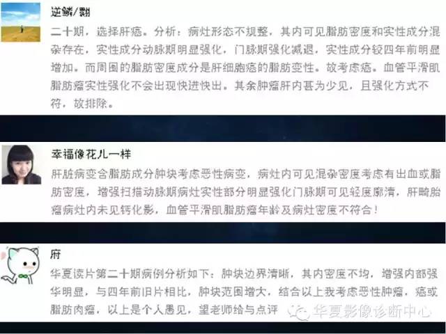 【病例学习】原发性肝癌伴脂肪变性一例影像表现
