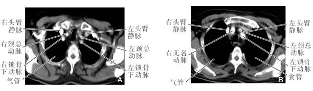血管CT成像及常见疾病的影像诊断