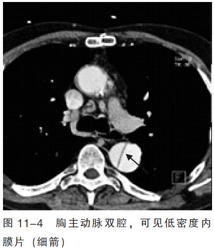 血管CT成像及常见疾病的影像诊断