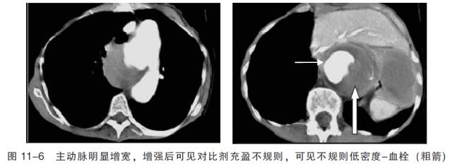 血管CT成像及常见疾病的影像诊断