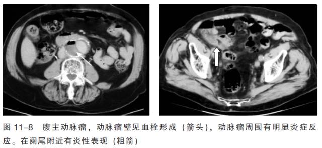 血管CT成像及常见疾病的影像诊断