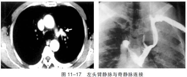 血管CT成像及常见疾病的影像诊断