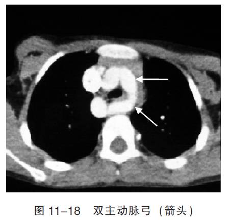 血管CT成像及常见疾病的影像诊断