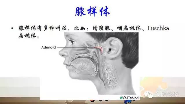 腺样体肥大的影像诊断