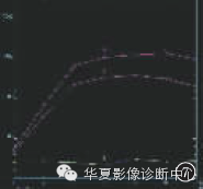 【病例学习】乳腺炎性肌纤维母细胞瘤1例 【病例学习】乳腺炎性肌纤维母细胞瘤1例