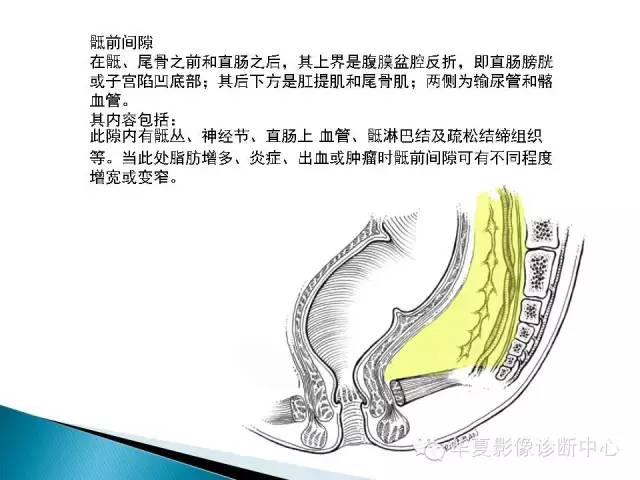 骶前肿物的影像分析