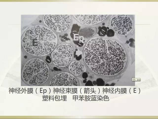 关于部分外周神经源性肿瘤的关系的初探