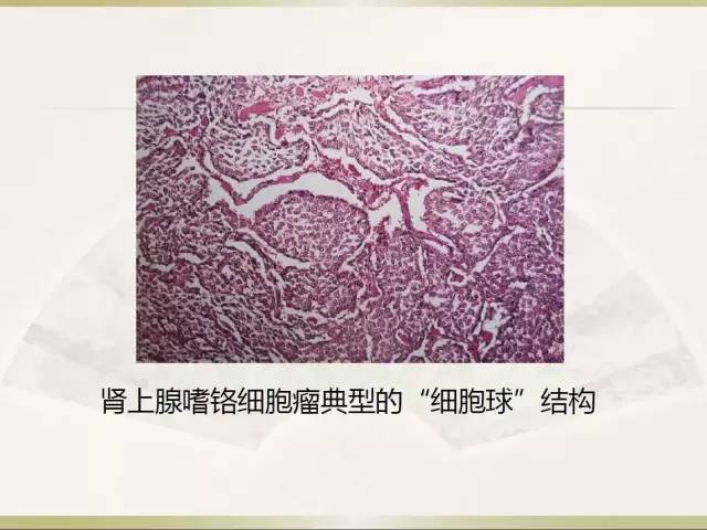 关于部分外周神经源性肿瘤的关系的初探