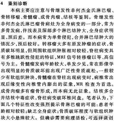 【双语病例】骨原发性淋巴瘤一例影像表现