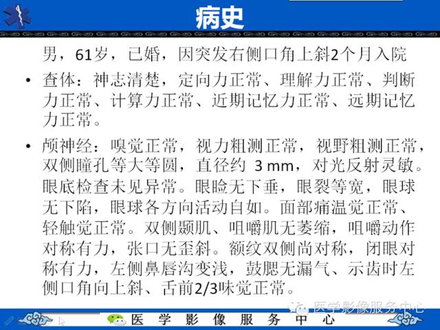 【病例学习】右额叶低级别星形细胞瘤1例MR影像表现