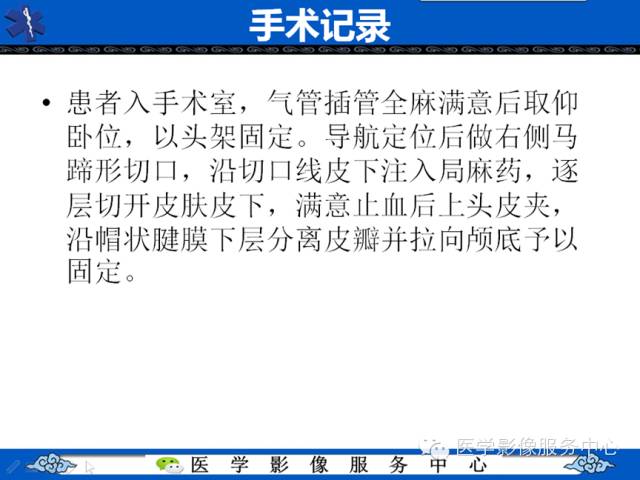 【病例学习】右额叶低级别星形细胞瘤1例MR影像表现