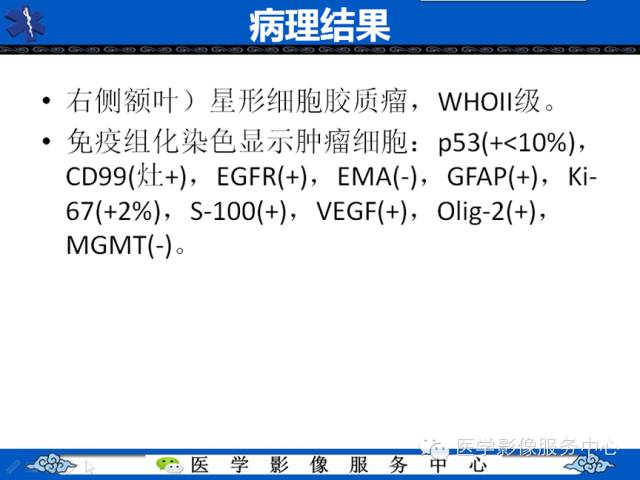 【病例学习】右额叶低级别星形细胞瘤1例MR影像表现