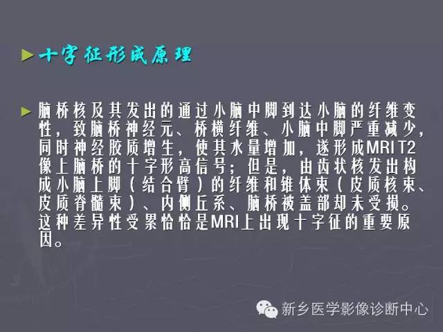 【PPT】关于“十”字征的经典总结