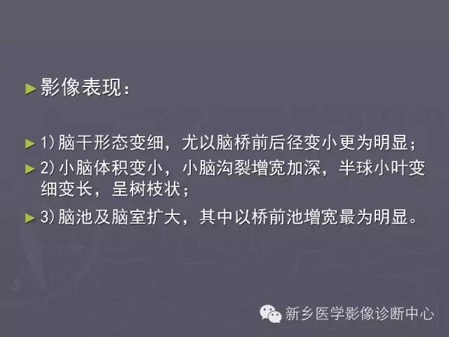 【PPT】关于“十”字征的经典总结