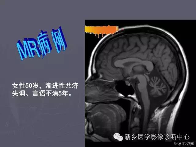【PPT】关于“十”字征的经典总结