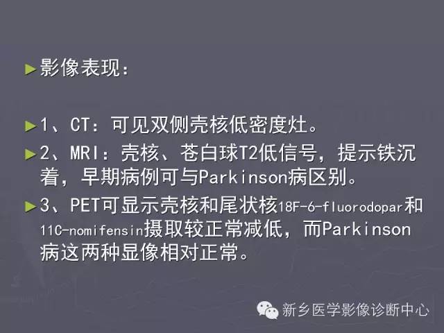 【PPT】关于“十”字征的经典总结
